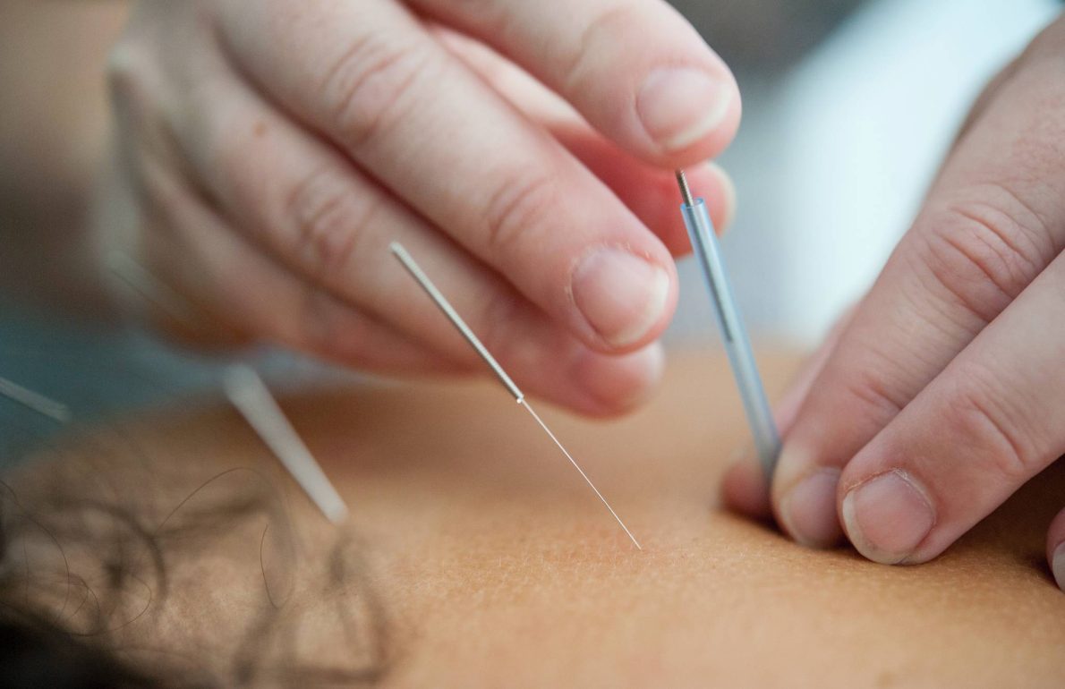 Azure Healing | clearwater acupuncture