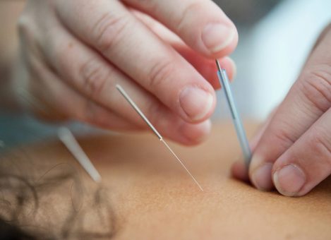 Service Directory | clearwater acupuncture
